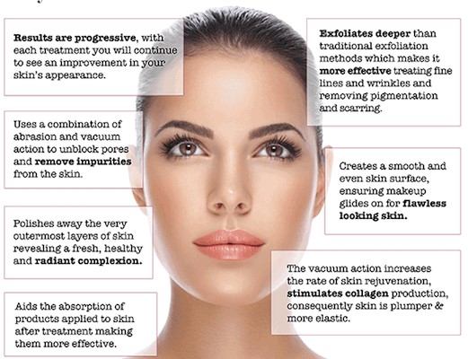 microdermabrasion where to get it done